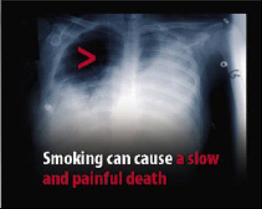 EU 2004 Health Effects death - internal image